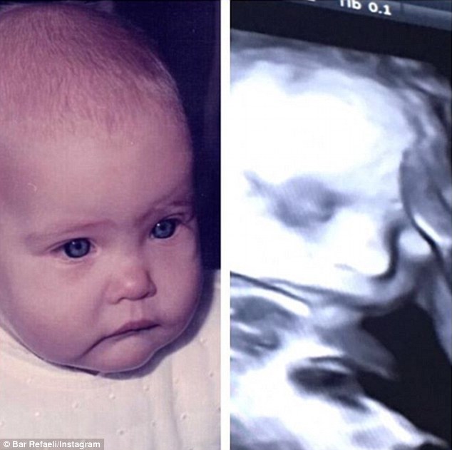 Like mother like daughter? The 30-year-old supermodel shared an adorable snap comparing her as a baby (left) with the first baby scan (right)