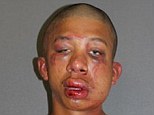 Raymond Frolander, 18, (pictured in his mugshot today) was beaten to a pulp by the father of the 11-year-old boy that he allegedly caught his sexually assaulting at a home in Dayton Beach, Florida